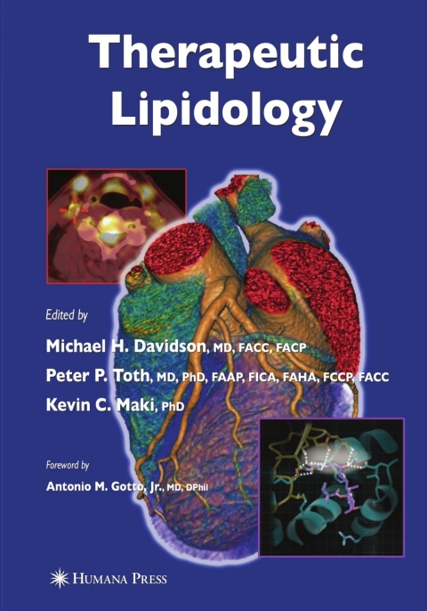 Cover image for book Therapeutic Lipidology