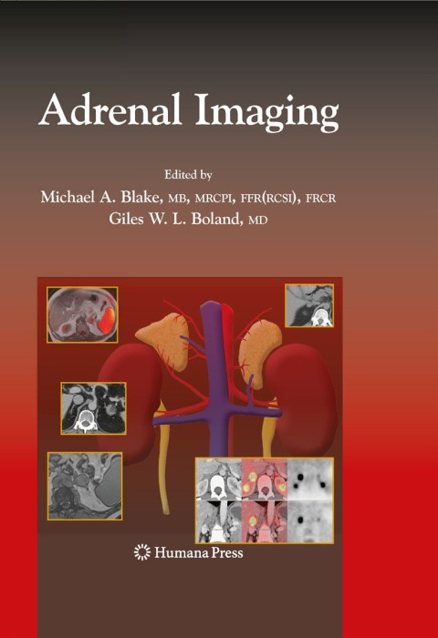 Adrenal Imaging 