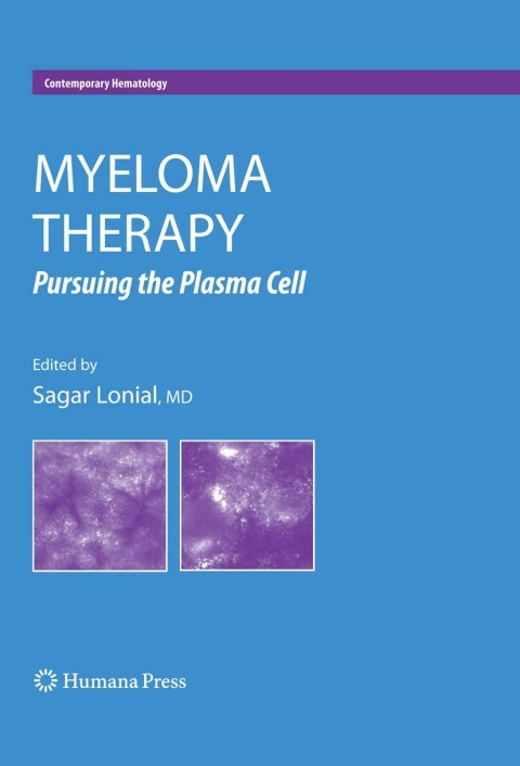 Cover image for book Myeloma Therapy