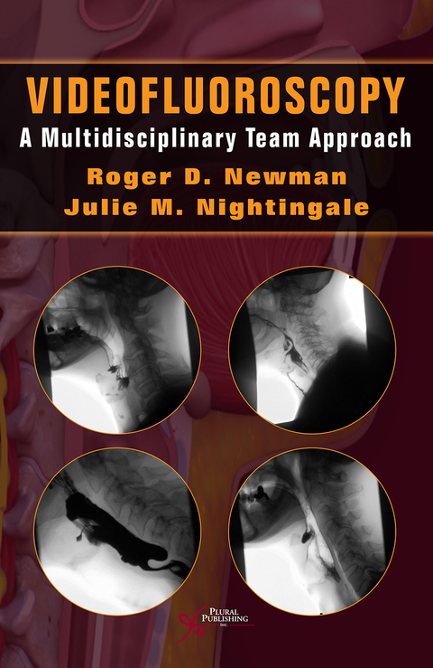 Cover image for book Videofluoroscopy: A Multidisciplinary Team Approach