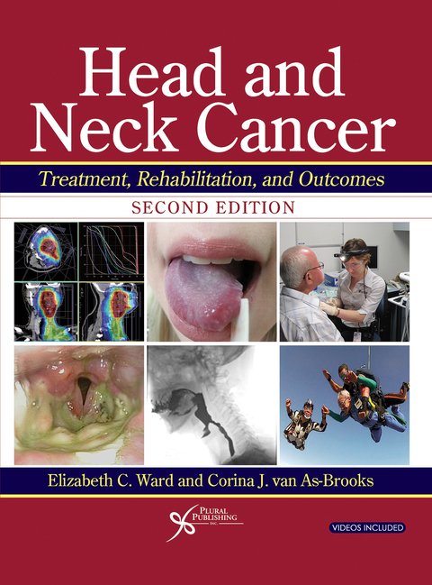 Cover image for book Head and Neck Cancer: Treatment, Rehabilitation, and Outcomes