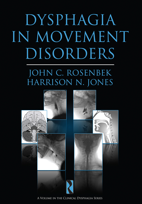 Cover image for book Dysphagia in Movement Disorders