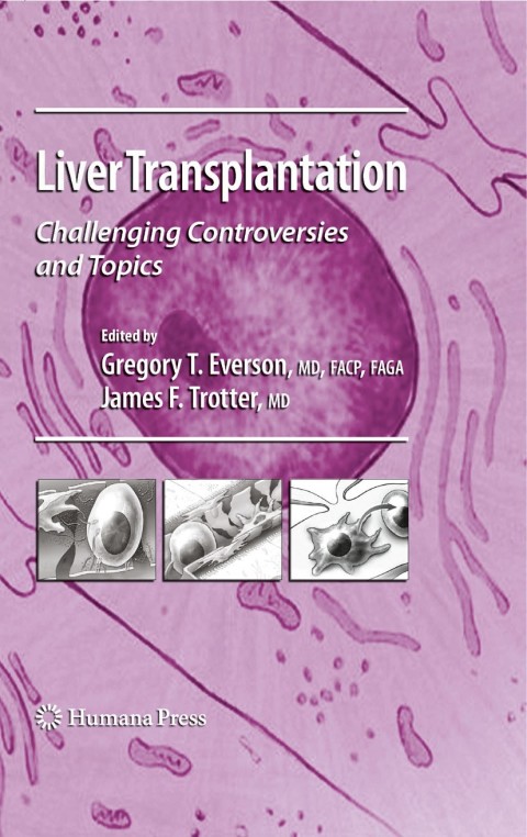 Cover image for book Liver Transplantation