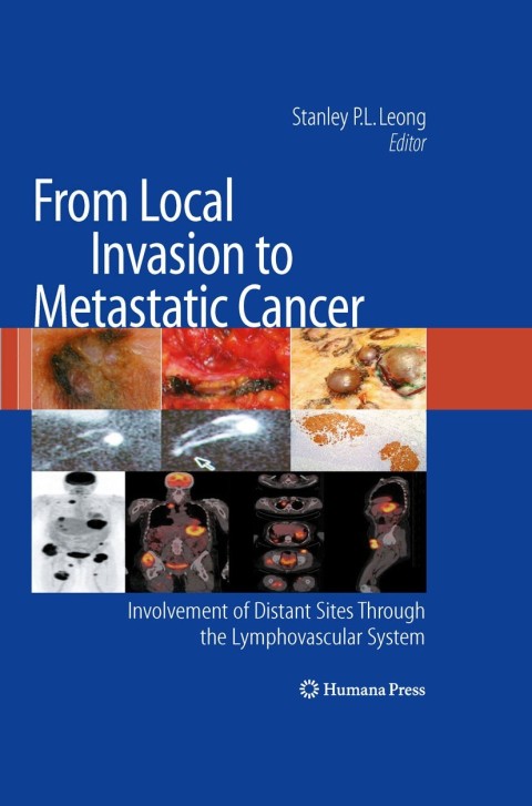 Cover image for book From Local Invasion to Metastatic Cancer