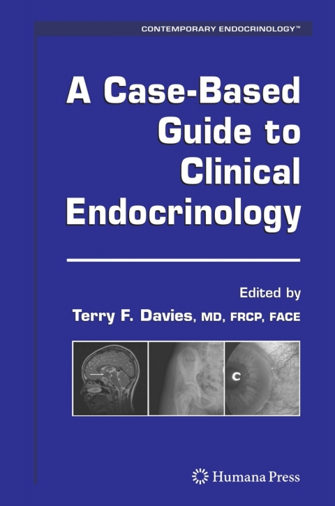 Cover image for book A Case-Based Guide to Clinical Endocrinology