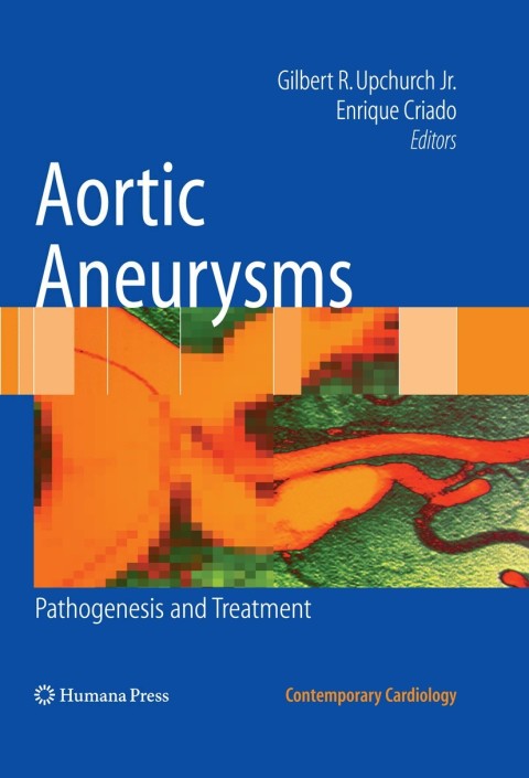 Cover image for book Aortic Aneurysms