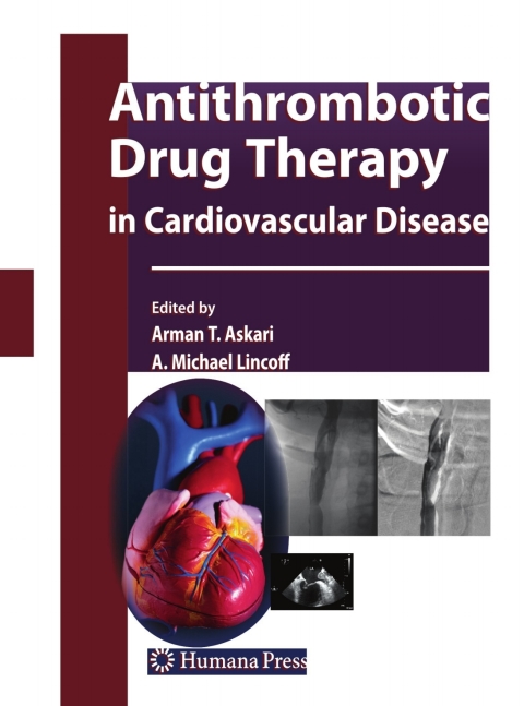 Cover image for book Antithrombotic Drug Therapy in Cardiovascular Disease