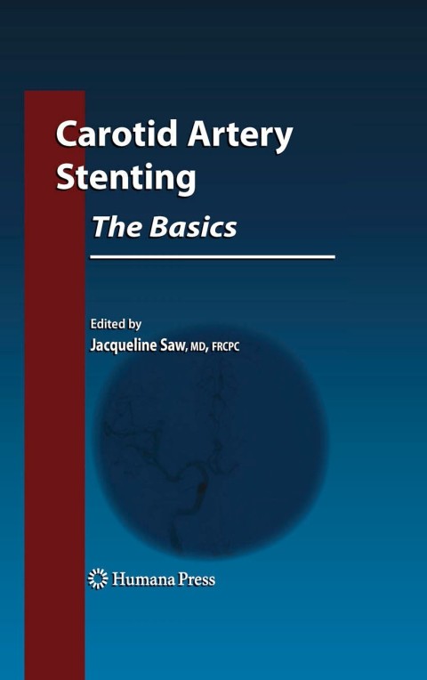 Cover image for book Carotid Artery Stenting: The Basics
