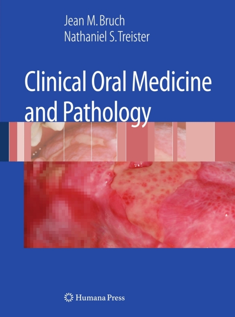 Cover image for book Clinical Oral Medicine and Pathology