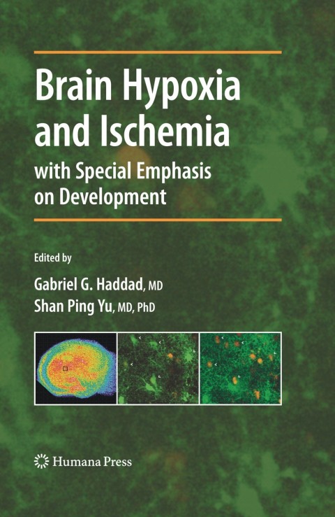 Cover image for book Brain Hypoxia and Ischemia