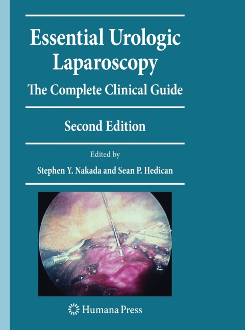 Cover image for book Essential Urologic Laparoscopy
