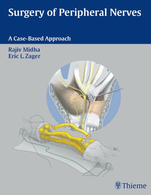Cover image for book Surgery of Peripheral Nerves