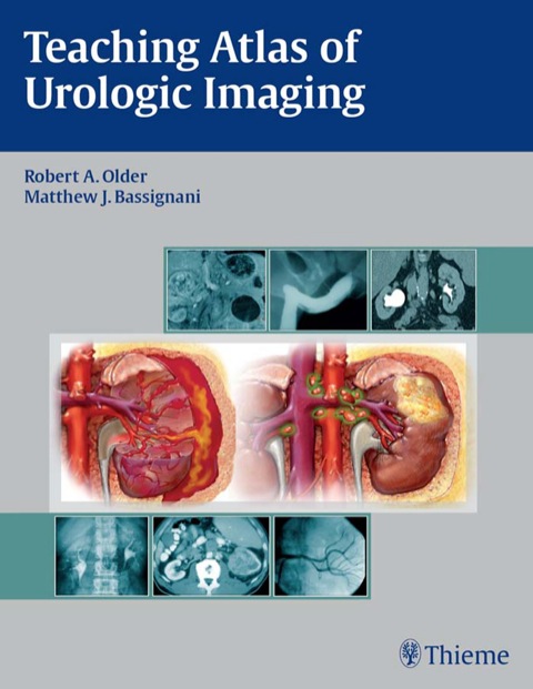 Cover image for book Teaching Atlas of Urologic Imaging