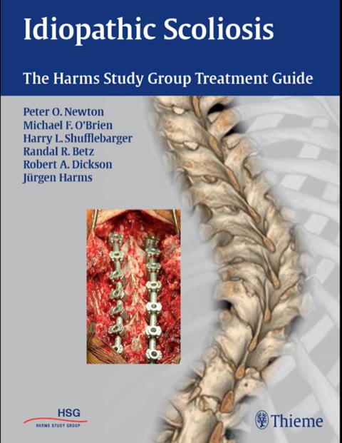 Cover image for book Idiopathic Scoliosis