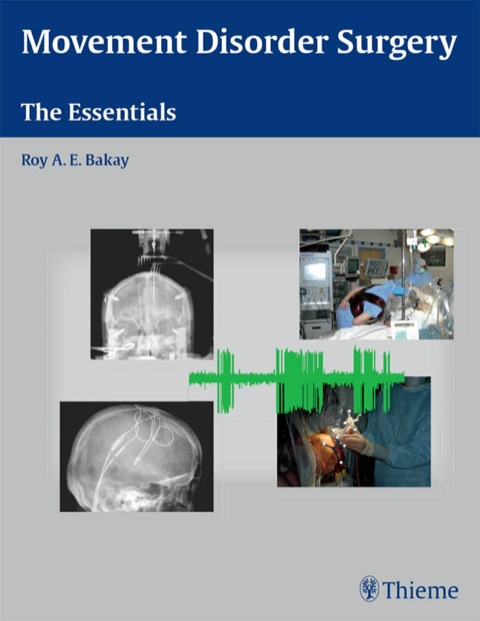 Cover image for book Movement Disorder Surgery