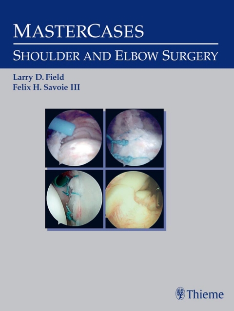 Cover image for book MasterCases in Shoulder and Elbow Surgery