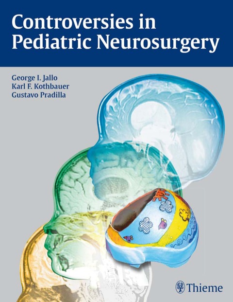 Cover image for book Controversies in Pediatric Neurosurgery