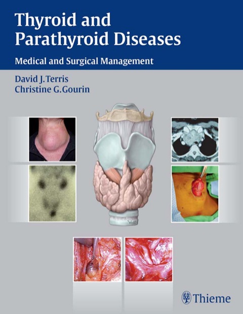 Cover image for book Thyroid and Parathyroid Diseases