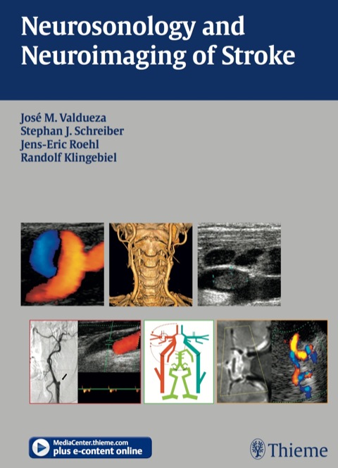 Cover image for book Neurosonology and Neuroimaging of Stroke
