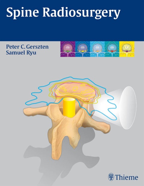 Cover image for book Spine Radiosurgery