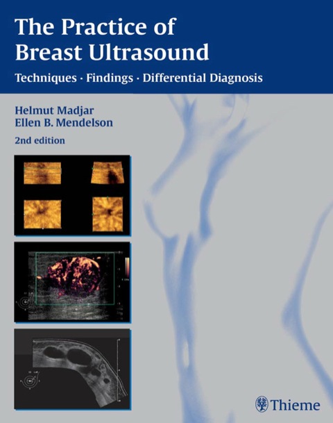 Cover image for book Practice of Breast Ultrasound: Techniques, Findings, Differential Diagnosis