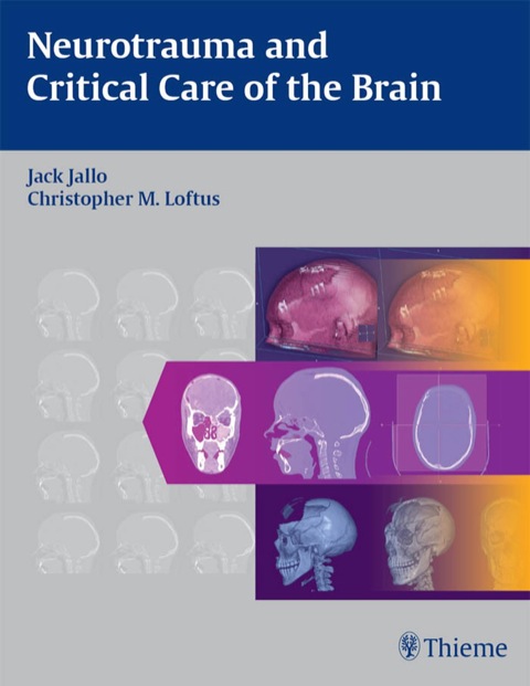 Cover image for book Neurotrauma and Critical Care of the Brain