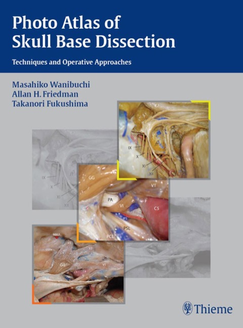 Cover image for book Photo Atlas of Skull Base Dissection
