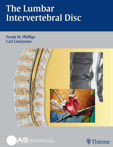 Cover image for book The Lumbar Intervertebral Disc