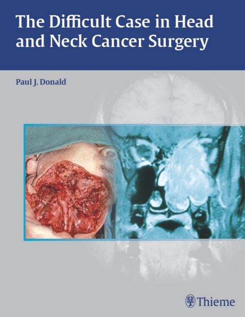 The Difficult Case in Head and Neck Cancer Surgery 