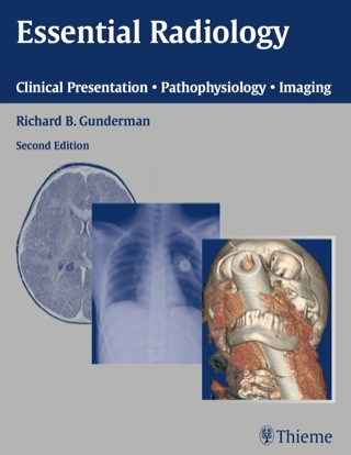 Essential Radiology
