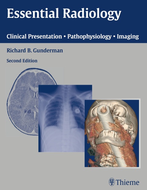 Cover image for book Essential Radiology
