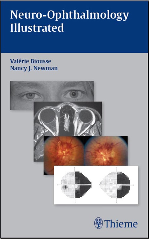 Cover image for book Neuro-Ophthalmology Illustrated