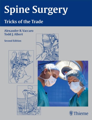 Spine Surgery