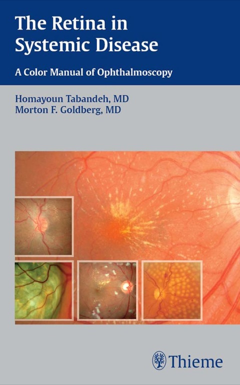 Cover image for book The Retina in Systemic Disease