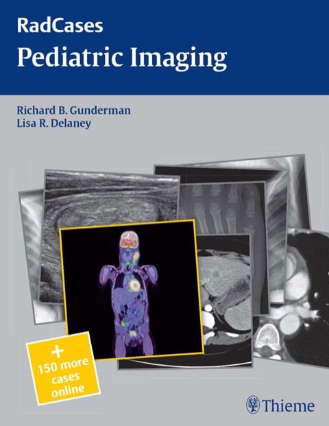 Cover image for book Pediatric Imaging