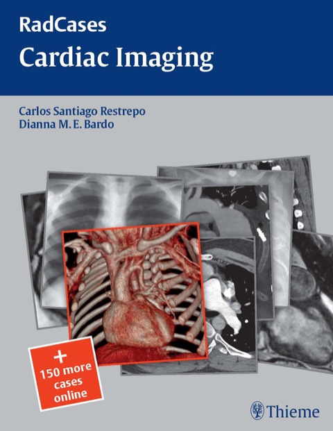 Cover image for book Radcases Cardiac Imaging