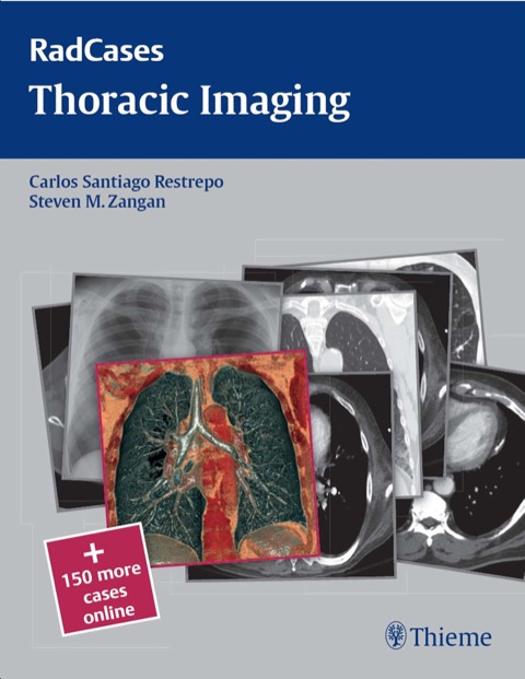 Cover image for book Thoracic Imaging