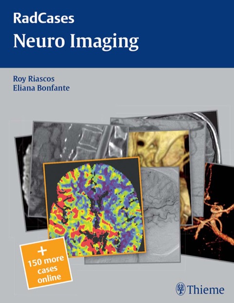 Neuro Imaging 