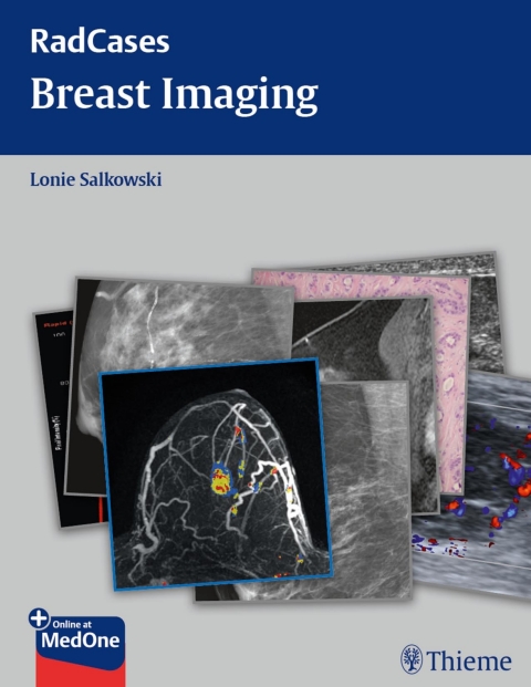 Cover image for book Radcases Breast Imaging