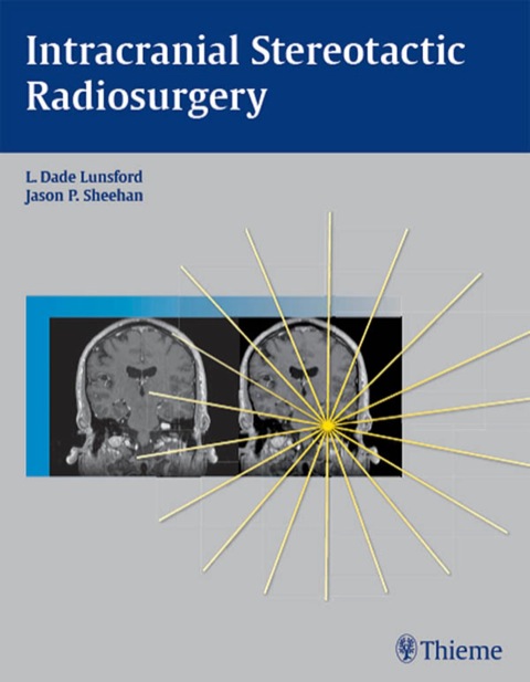 Intracranial Stereotactic Radiosurgery 