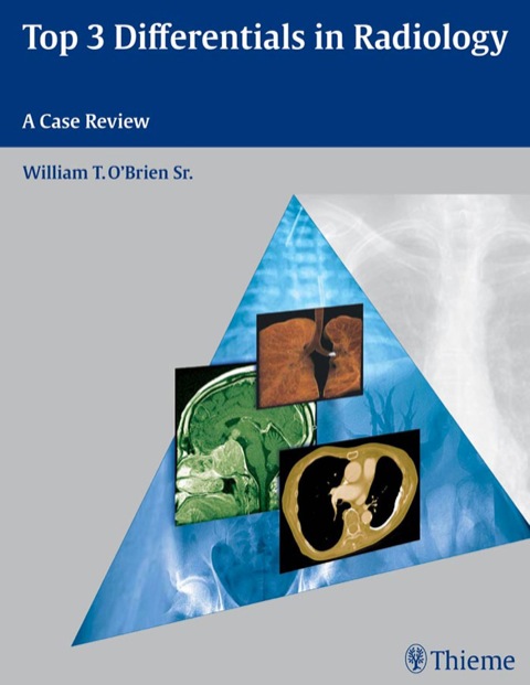 Cover image for book Top 3 Differentials in Radiology