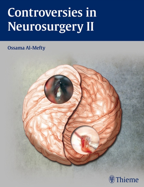 Cover image for book Controversies in Neurosurgery II
