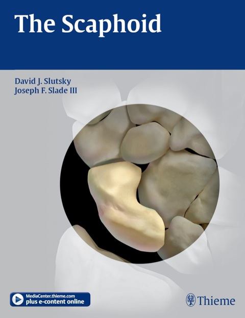 Cover image for book Scaphoid