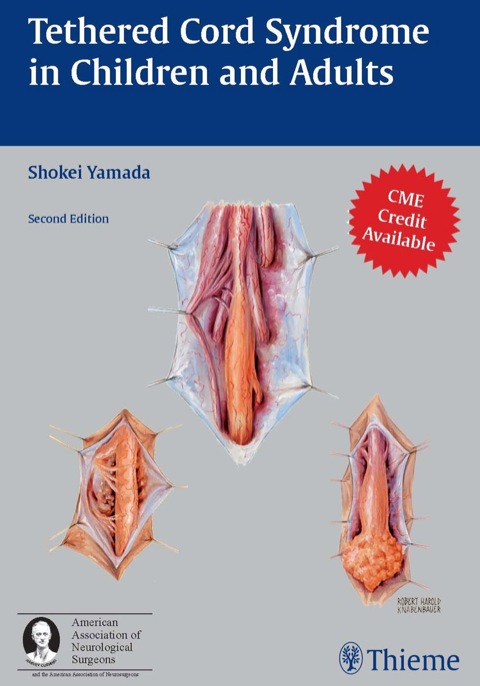 Cover image for book Tethered Cord Syndrome in Children and Adults