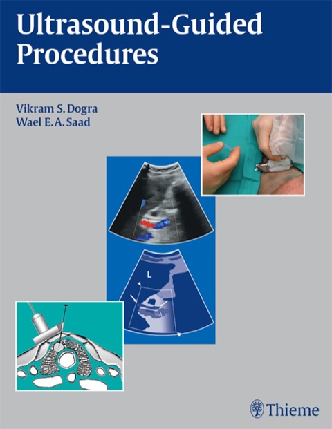 Cover image for book Ultrasound-Guided Procedures