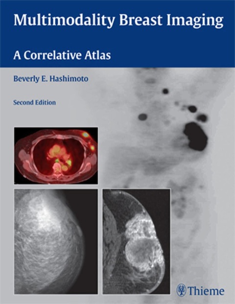 Cover image for book Multimodality Breast Imaging