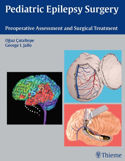 Cover image for book Pediatric Epilepsy Surgery