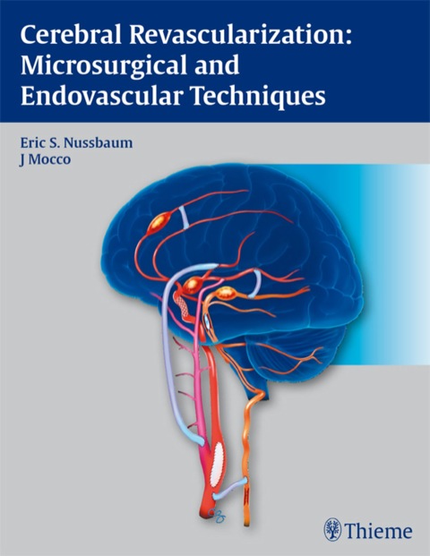 Cover image for book Cerebral Revascularization