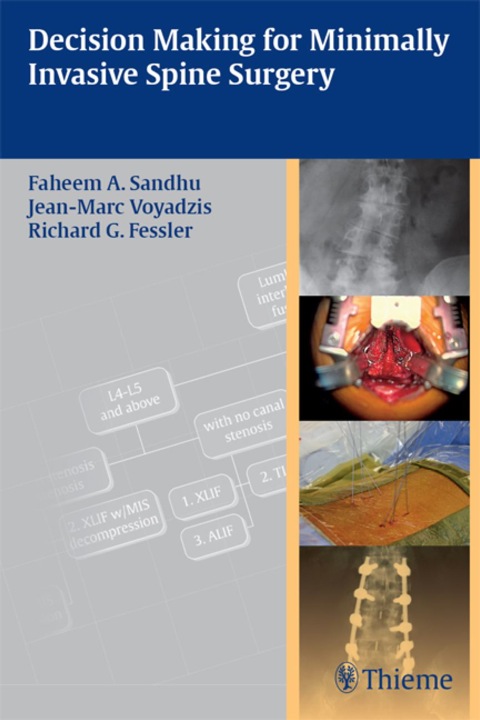 Cover image for book Decision Making for Minimally Invasive Spine Surgery