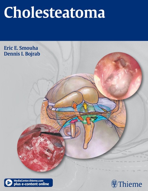 Cover image for book Cholesteatoma